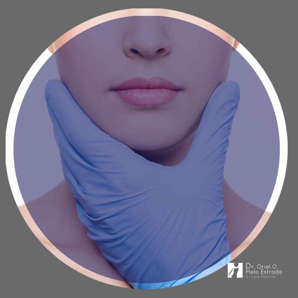Rinoplastía Cirugía estética de la nariz
