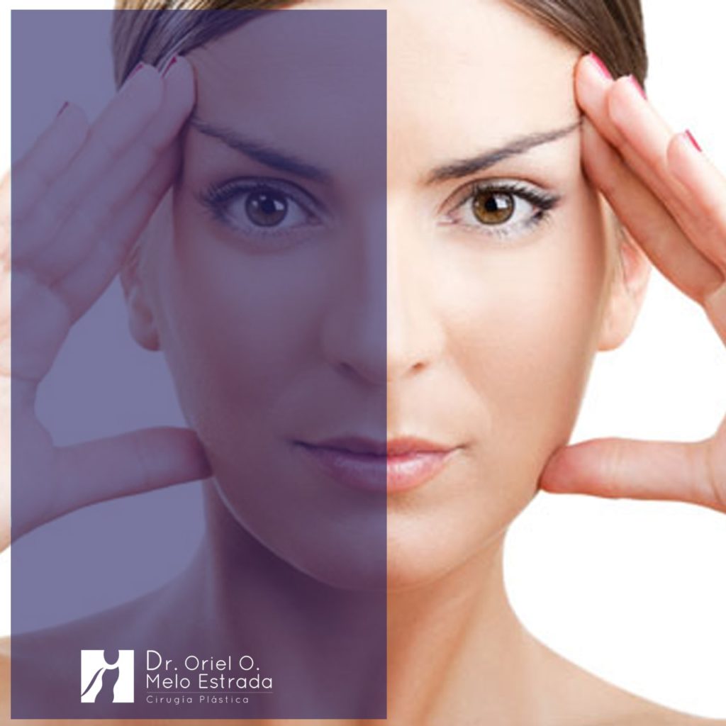 Rejuvenecimiento Facial Quirurico